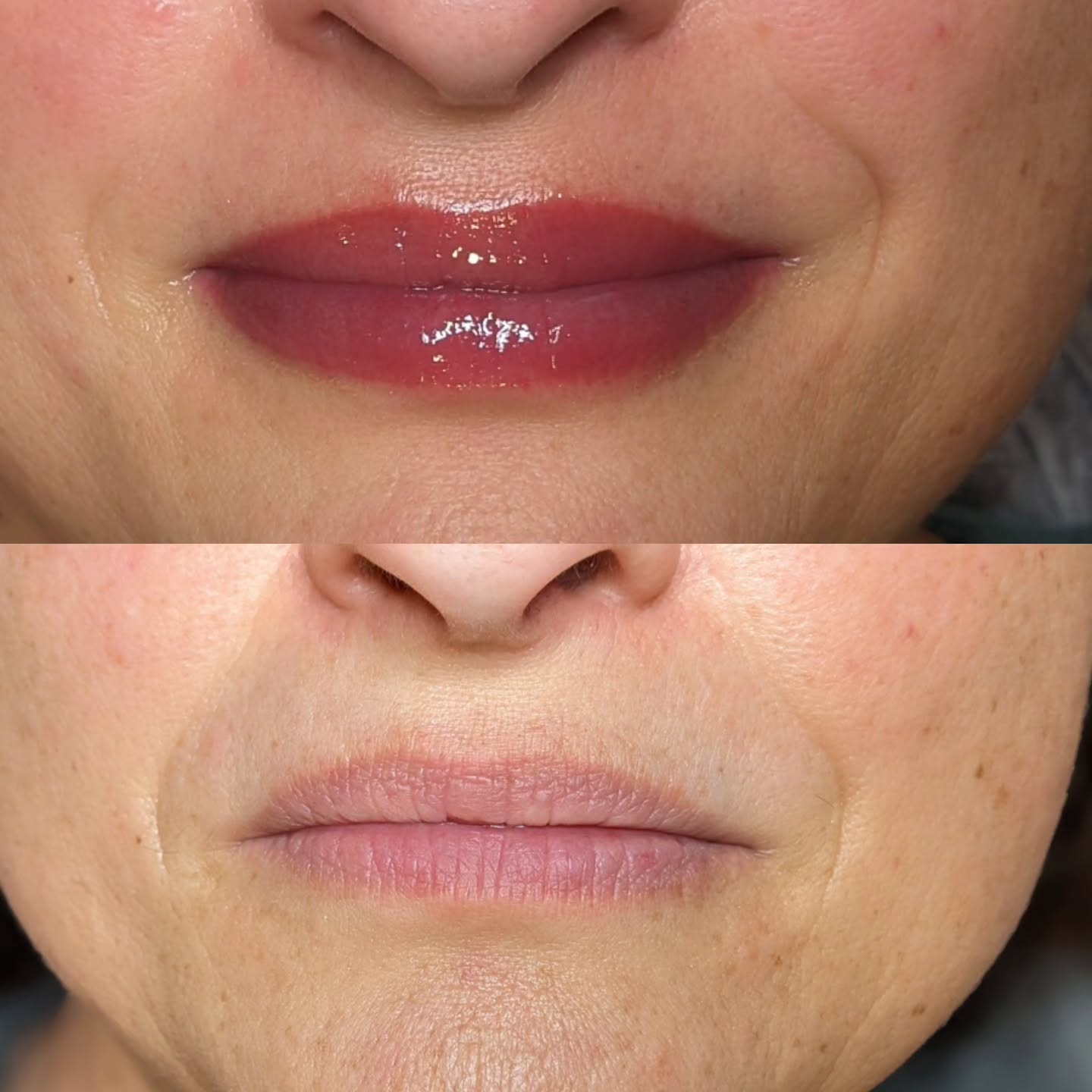 Vorher-Nachher-Vergleich einer Lippenpigmentierung